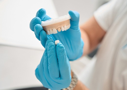 Dental team member holding model with dental crown