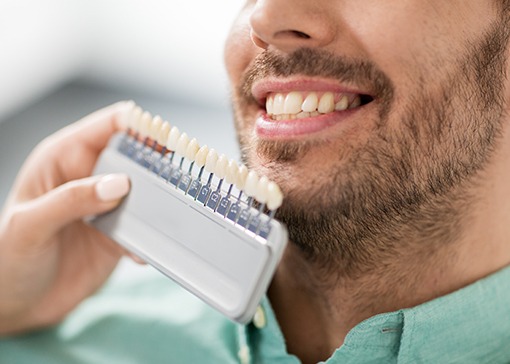 Man's smile compared with tooth color chart