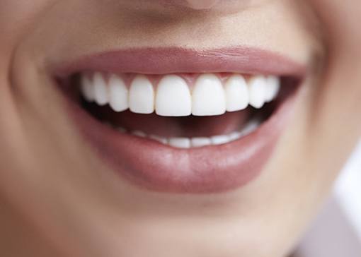 Flawless smile after cosmetic dentistry services