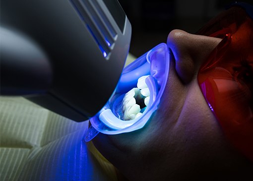 Man receiving professional teeth whitening