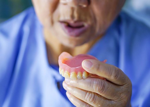 A woman who’s just removed her denture