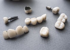 Sample dental implant supported dental crowns and bridges