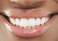 Closeup of smile after gum disease treatment