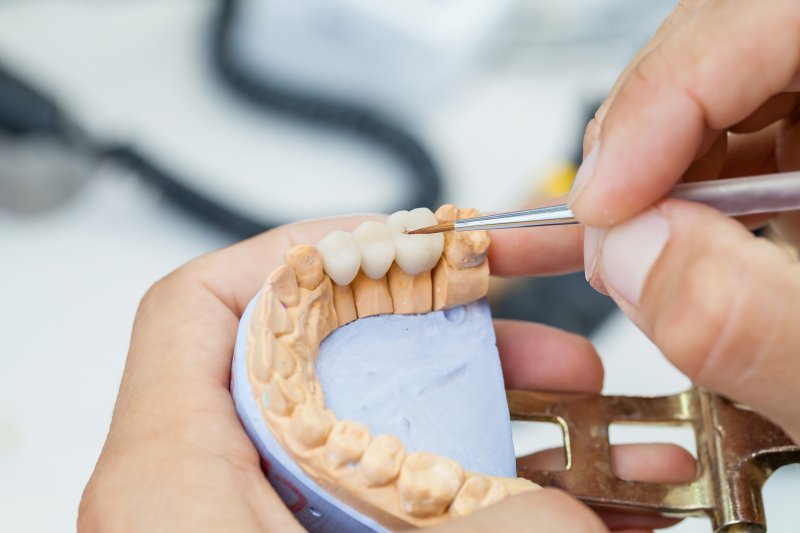 dentist working on dental bridge